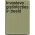 Invasieve gistinfecties in Beeld