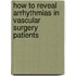 How to Reveal Arrhythmias in Vascular Surgery Patients