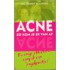 Acne zo kom je er van af