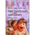 Het syndroom van Down