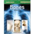 Bones