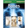 Bones door Christine Webster