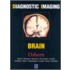 Brain
