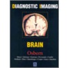 Brain by Susan I. Blaser