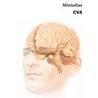 Miniatlas CVA by L.R. Lepori