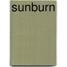 Sunburn door Sharon Gordon