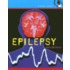 Epilepsy