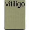 Vitiligo door Seung-Kung Hann