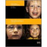 Strabismus by James Wong