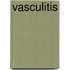 Vasculitis