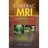 Cardiac Mri