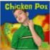 Chicken Pox