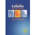 Cellulite - daar kun je vanaf!