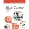 Skin Cancer by Po-Lin So