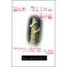 Man Bites Log by Max Alexander