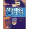 Missing Teeth by Roger M. Watson