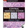 Nervous System door Hannes Vogel