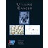 Uterine Cancer