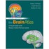 The Brain Atlas