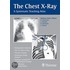 The Chest X-ray