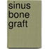 Sinus Bone Graft