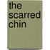 The Scarred Chin
