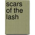Scars Of The Lash