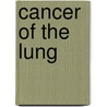 Cancer of the Lung door Alan B. Weitberg