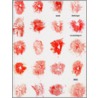 Wim Delvoye