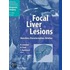 Focal Liver Lesions