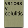 Varices y Celulitis by Ursula Pia Tropper