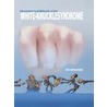 Elementaire bedrijfskunde en het White Knuckle Syndrome