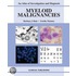 Myeloid Malignancies