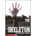 The Runaway Skeleton