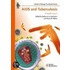 Aids And Tuberculosis