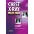 Chest X-Ray Made Easy