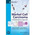Merkel Cell Carcinoma