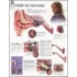 Middle Ear Infections