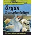 Organ Transplantation