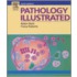 Pathology Illustrated