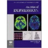 An Atlas of Depression door David Baldwin