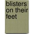 Blisters On Their Feet