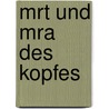 Mrt Und Mra Des Kopfes door Detlev Uhlenbrock