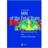 Mri Of The Fetal Brain door Catherine Garel