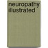 Neuropathy Illustrated