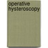 Operative Hysteroscopy