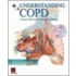 Q&a Understanding Copd