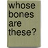 Whose Bones Are These?