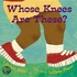 Whose Knees are These?