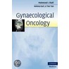 Gynaecological Oncology door Mahmood Shafi